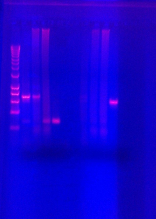 Positive test results, indicated by the flourescent bands.